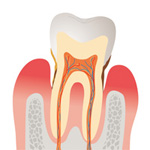 歯周病治療